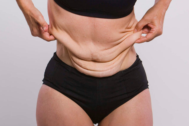 How to Tone Saggy Skin After Weight Loss: Expert Tips 3 How to Tone Saggy Skin After Weight Loss: Expert Tips