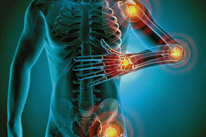 Inflammatory Markers - What They Are and How They Help Manage Inflammation
