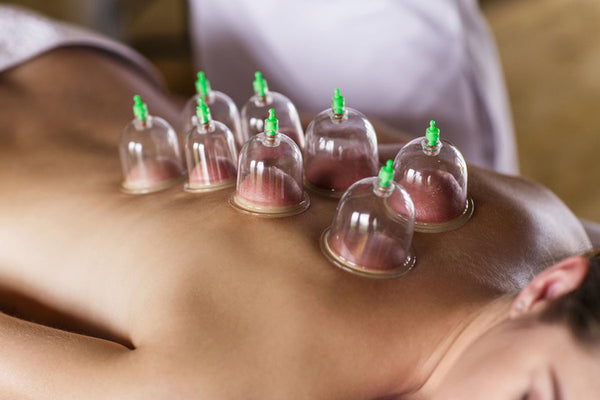 The Benefits of Cupping Therapy